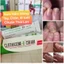KEM DƯỠNG NẤM DA TAY THÁI LAN [SẴN][FREESHIP][CHUẨN HÀNG][BẢO HÀNH 7 NGÀY]