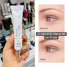 thâm mắt Ốc Sên Cha-Skin Snail Eye Cream kem dưỡng mắt giảm quầng thâm mắt chống thâm mắt kem tan bọng mắt