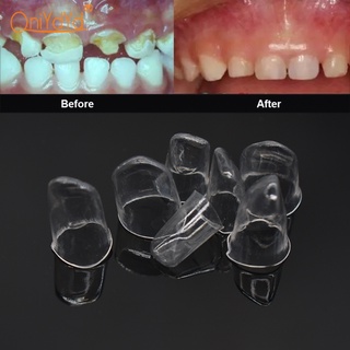 Bộ 64 Vương Miện Bằng Nhựa Trong Suốt Chuyên Dùng Cho Nha Khoa