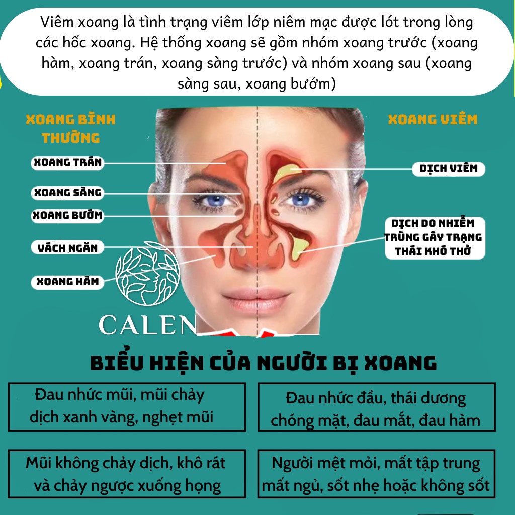 [Xoang mãn tính] Trà xoang mũi Calen giảm tình trạng dị ứng mũi,chảy nước mũi, sổ mũi, đau mũi, khó thở bịch 30 gói lọc