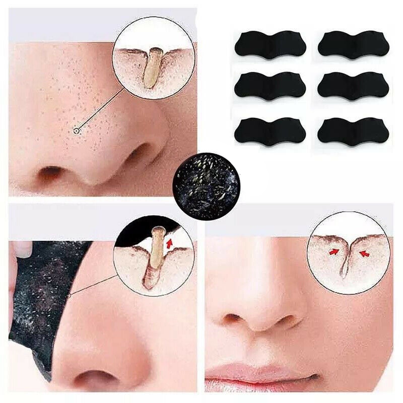 Mặt Nạ Lột Mụn Đầu Đen Làm Sạch Sâu Lỗ Chân Lông Cho Mũi