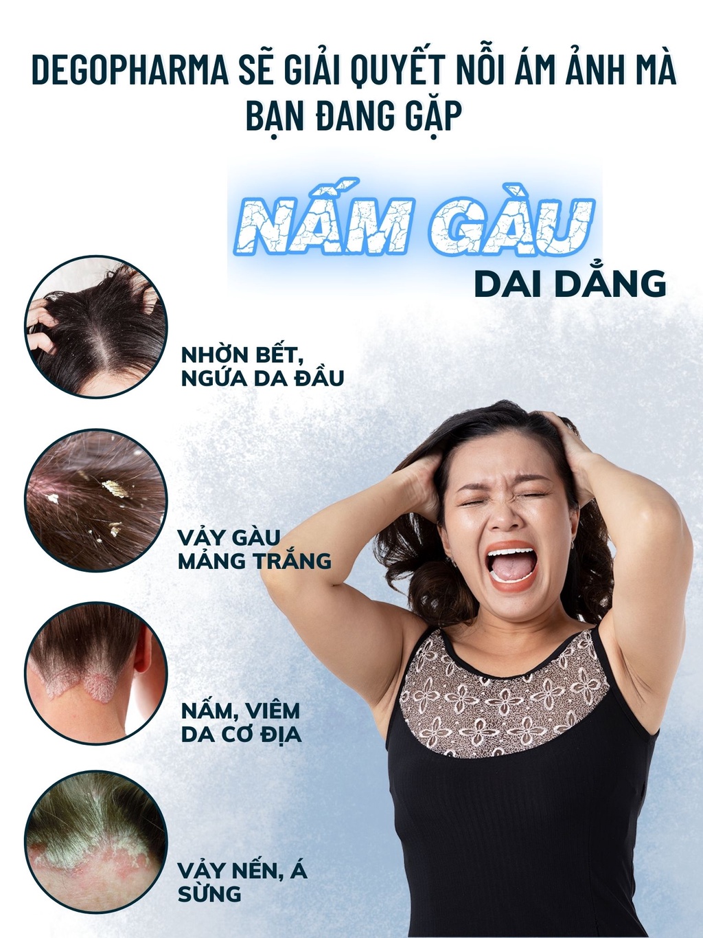 Mô tả Combo 3 Dầu Gội Sạch Nấm DEGO PHARMA 80ml - Dứt Điểm Gàu Ngứa & Nấm Da Đầu - Chiết Xuất Thiên Nhiên - 2