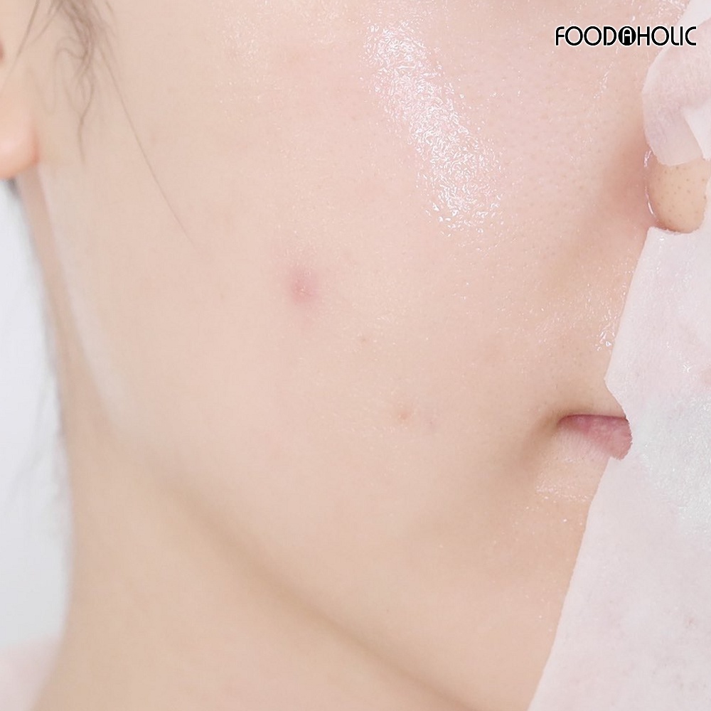 Ảnh Combo 10 Mặt nạ giảm mụn, tái tạo da Foodaholic Retinol Anti Acnes Mask 23ml x 10 - RETINOL 3
