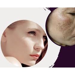 ⭐ 10 MIẾNG ⭐ Sỉ 10 𝐌𝐚̣̆𝐭 𝐧𝐚̣ nhau thai cừu nhật bản
