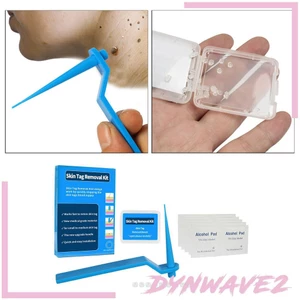 Sử dụng thiết bị xóa thẻ bổ sung