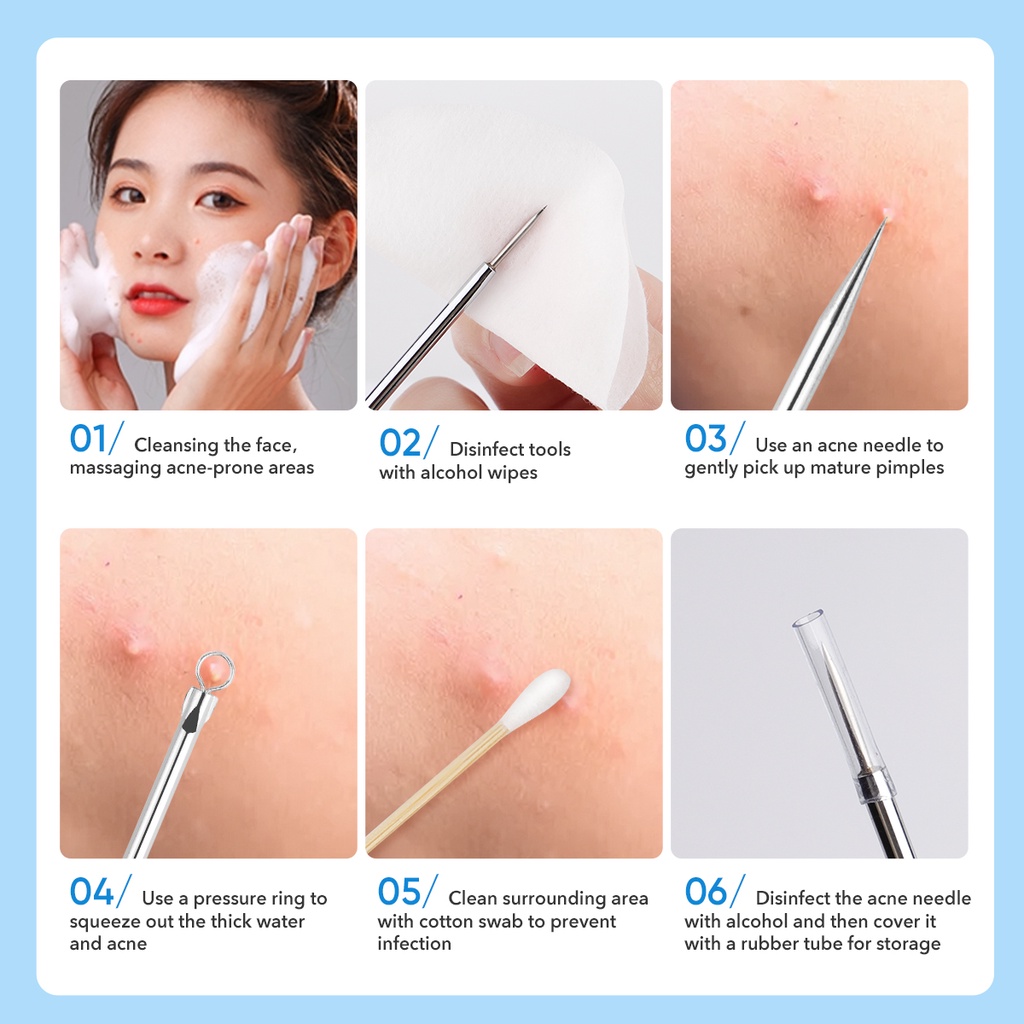 Ảnh Set 4 Kim châm mụn IMAGIC thiết kế 2 đầu chất liệu thép không gỉ có hộp đựng tiện dụng 3