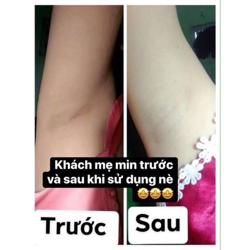 Kem Cô Bơ Thâm Nách Hôi Nách - Giảm Mùi Cực Kì Nhanh Hủ 8gr