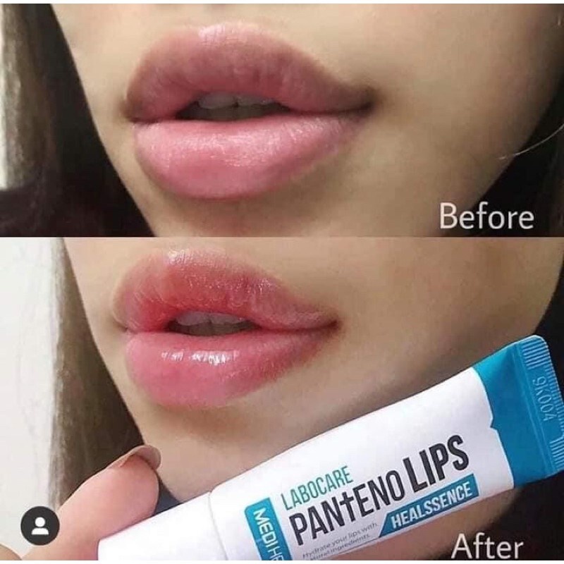 Son Dưỡng, Tẩy Da Chết Giảm Thâm Môi, Bong Tróc Mediheal Labocare Panteno Lips Healbalm