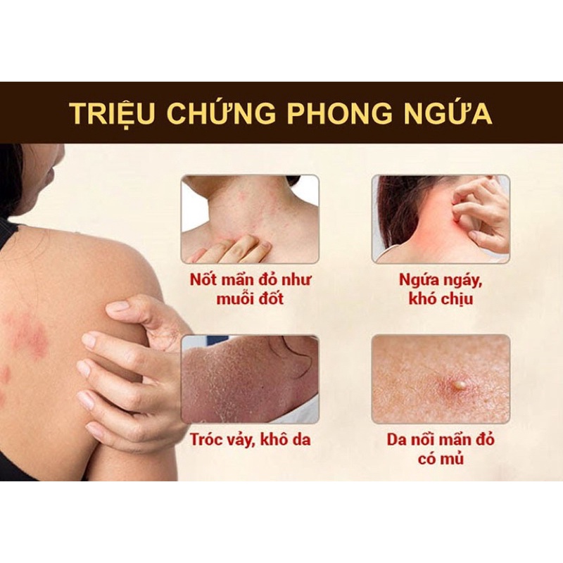 PHONG NGỨA GIA TRUYỀN THIÊN PHÚC 50ml