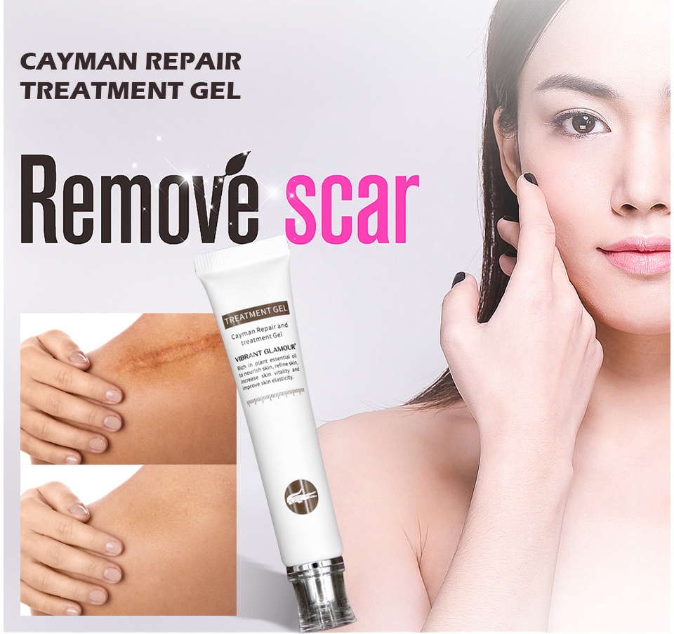 Mô tả Gel xóa sẹo VIBRANT GLAMOUR bỏng, vết cắt, vết rạn da, các loại sẹo, sẹo 20g - 2