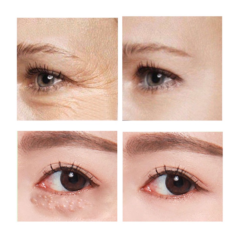 Kem Dưỡng Da VOVA Chứa Retinol Giúp Dưỡng Ẩm Xóa Mờ Quầng Thâm / Bọng Mắt Chống Lão Hóa / Nếp Nhăn Làm Săn Chắc Và Sáng Da