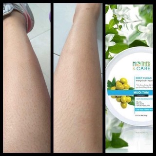 Muối tắm viêm nang lông