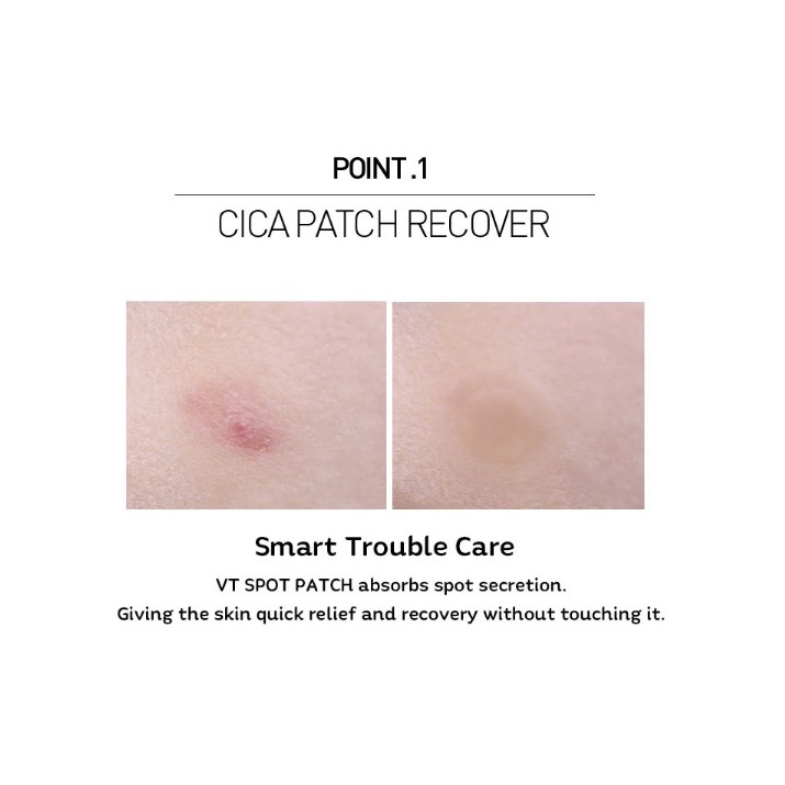 [VT] Spot Patch 12 / 48 Miếng dán / Miếng dán mụn / Miếng dán mụn trứng cá _ Jul
