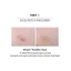 Spot Patch 12 / 48 Miếng dán / Miếng dán mụn / Miếng dán mụn trứng cá _ Jul