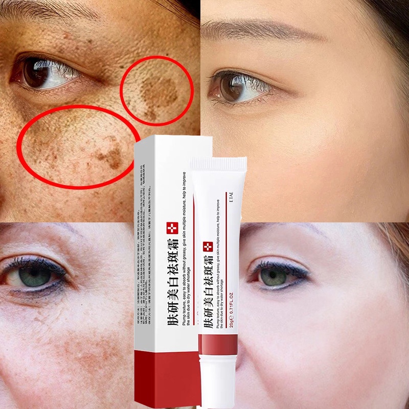 Kem Dưỡng Trắng Da Hỗ trợ giảm nám Và Vết Nám Hiệu Quả