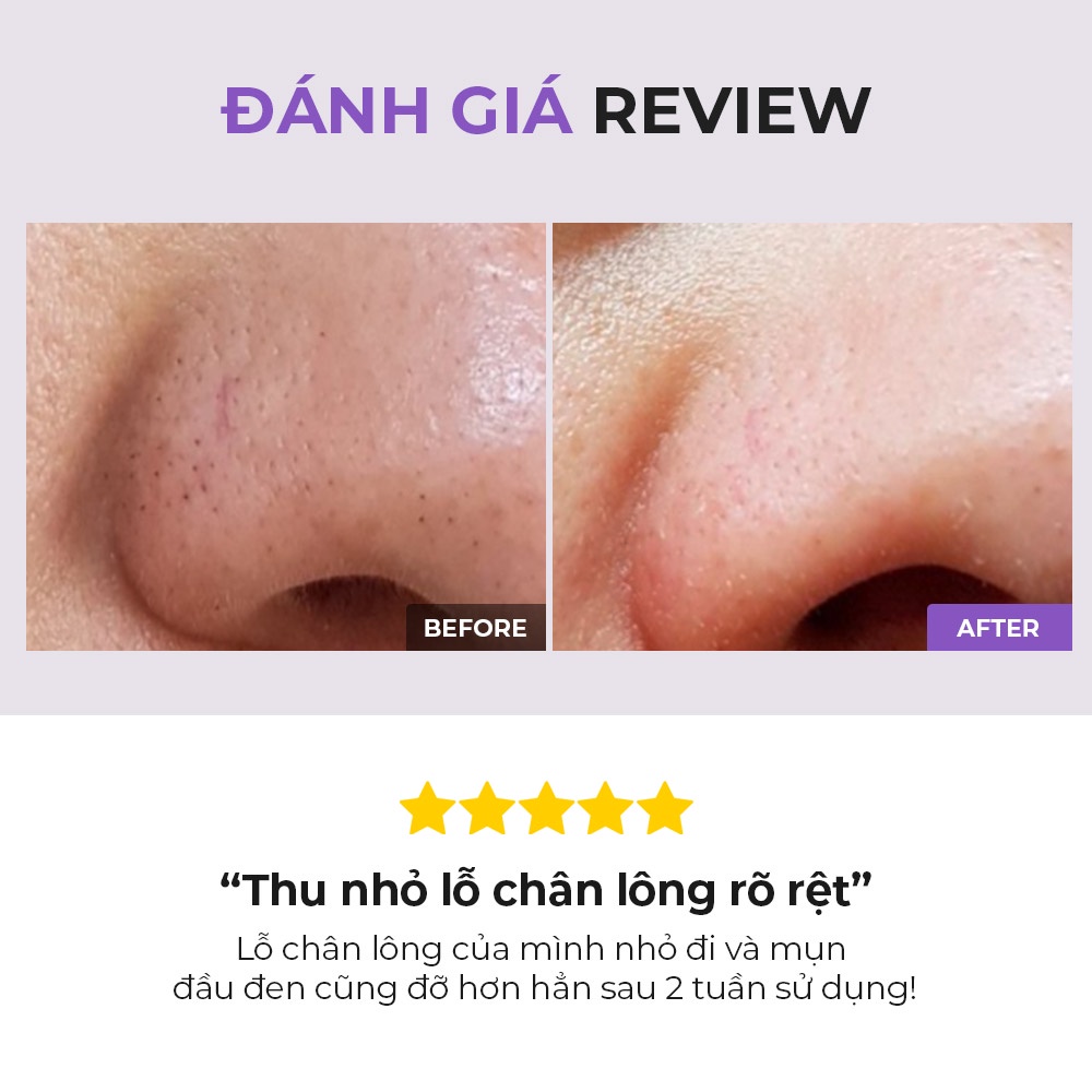 Ảnh COSRX OFFICIAL Nước cân bằng BHA hỗ trợ làm giảm mụn đầu đen dung tích 50ml/ 100ml 4