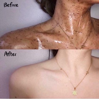 TẨY DA CHẾT BODY QUẾ HỒI