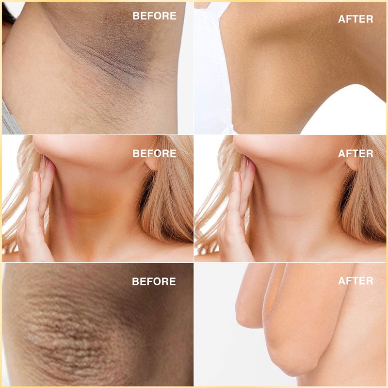 Kem Làm Trắng Da Toàn Thân Loại Bỏ Melanin Dưỡng Ẩm Làm Sáng Da