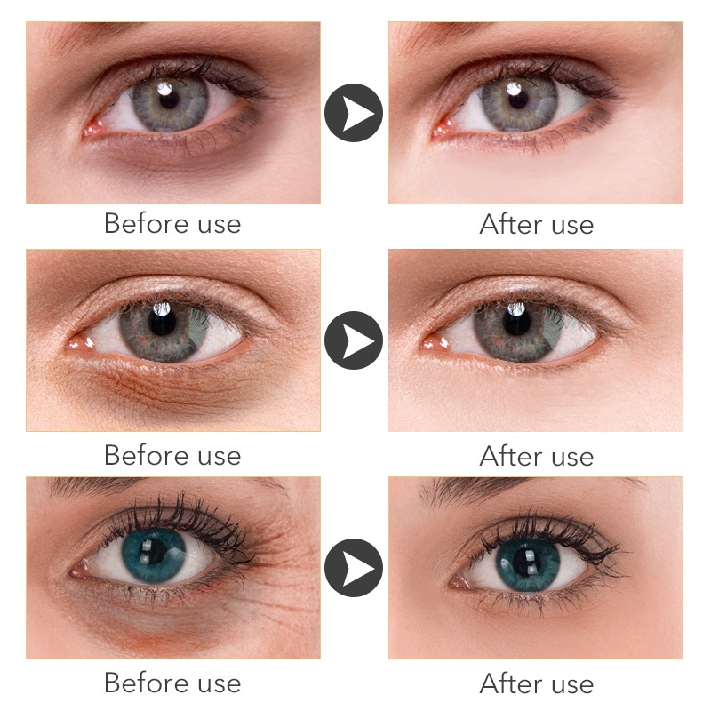 Kem Dưỡng Da VOVA Chứa Retinol Giúp Dưỡng Ẩm Xóa Mờ Quầng Thâm / Bọng Mắt Chống Lão Hóa / Nếp Nhăn Làm Săn Chắc Và Sáng Da