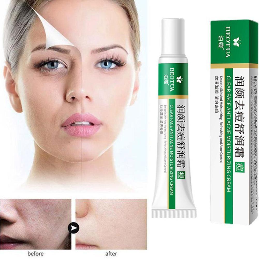 Kem Thảo Dược Hỗ trợ giảm mụn Kiểm Soát Dầu Dưỡng Ẩm Chăm Sóc Da Mặt 20g