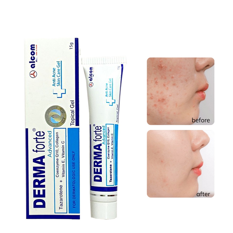 Ảnh Gel Giảm Mụn, Thâm Sẹo Và Dưỡng Da Gamma DERMA FORTE Gel 15g 3