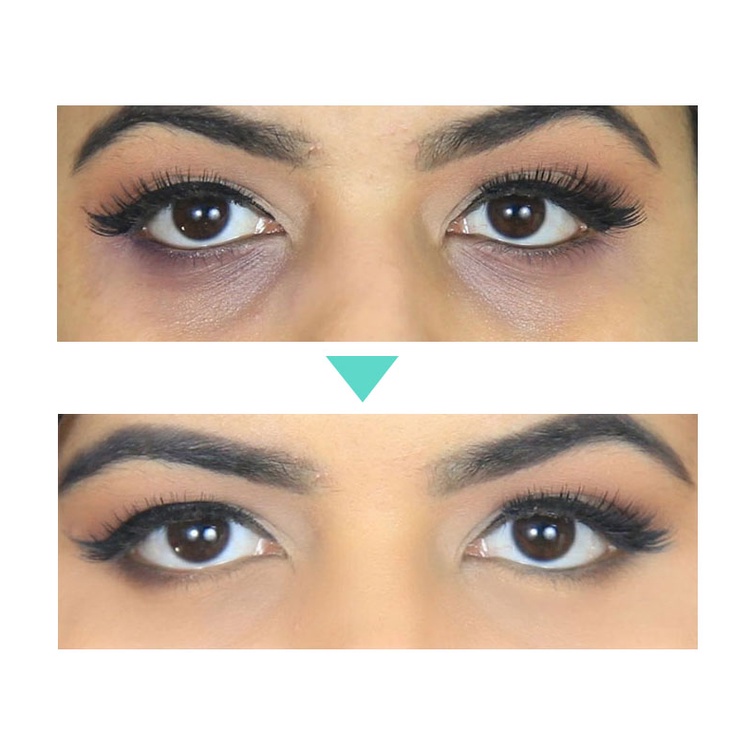 Kem Dưỡng Da VOVA Chứa Retinol Giúp Dưỡng Ẩm Xóa Mờ Quầng Thâm / Bọng Mắt Chống Lão Hóa / Nếp Nhăn Làm Săn Chắc Và Sáng Da