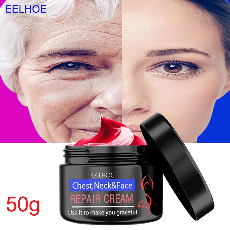 Kem Dưỡng Ẩm Làm Trắng Da Mặt Và Cổ Chống Lão Hóa 30g
