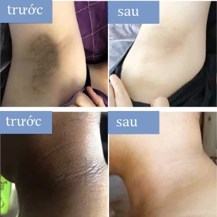 kem dưỡng trắng da toàn thân sữa dưỡng thể làm trắng da kem dưỡng trắng da 300g làm trắng da toàn thân dưỡng ẩm da