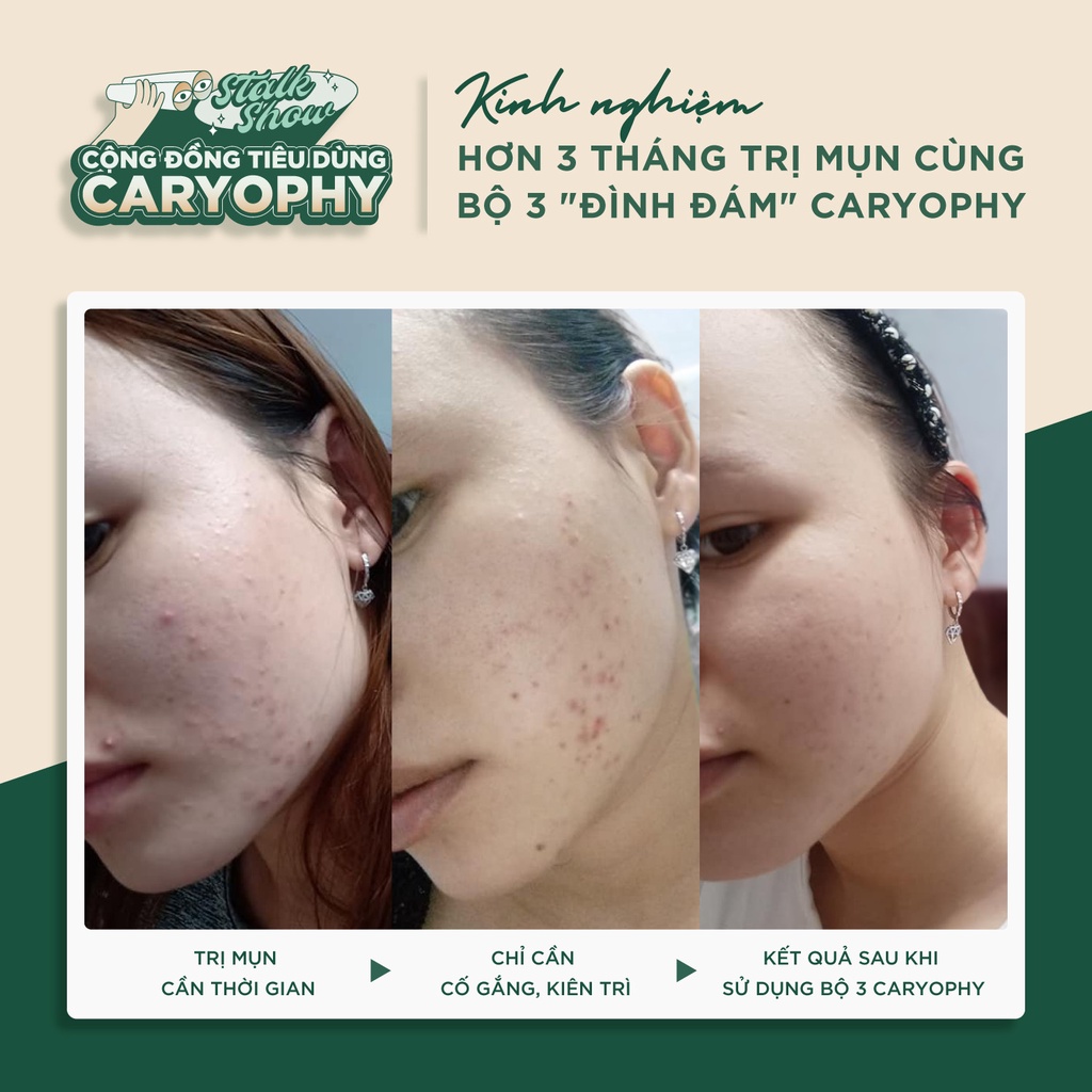 Ảnh Nước cân bằng không cồn cho da mụn Caryophy Portulaca Toner 300ml 4