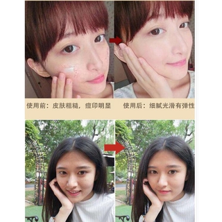 Kem làm trắng da thần kỳ 38g ♈ ❈ ❈ ❈ ❈ ❈ ❈ ❈ ◈ ❈