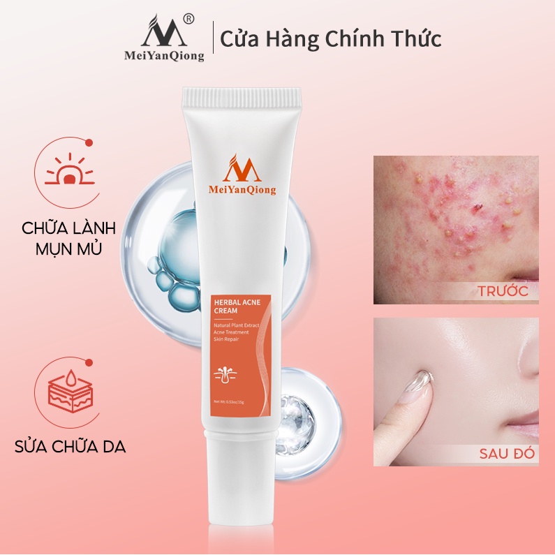 Kem dưỡng Hỗ Trợ Giảm Mụn MeiYanQiong cải thiện da thô ráp xỉn màu làm sáng màu da chăm dưỡng trắng 15g