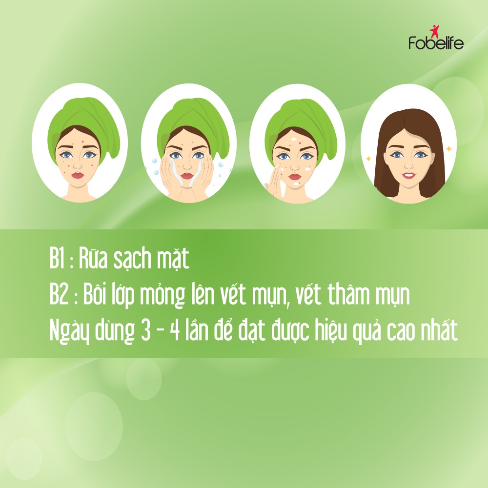 Kem Ngừa Thâm Mụn Tái Tạo Da, Mờ Thâm Bởi Mụn N1