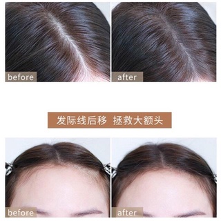 Phấn phủ bạc chân tóc, che khuyết điểm hói tóc bò liếm chân tóc Hamin
