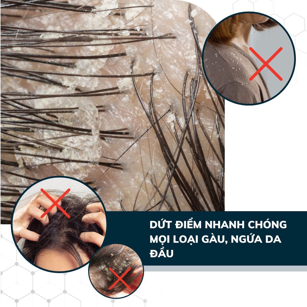 Ảnh Combo 3 Dầu Gội Sạch Nấm DEGO PHARMA 80ml - Dứt Điểm Gàu Ngứa & Nấm Da Đầu - Chiết Xuất Thiên Nhiên 4