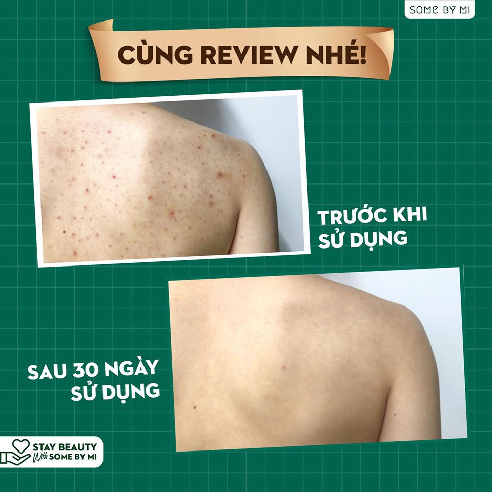 Ảnh Sữa Tắm Giảm Mụn Lưng AHA BHA PHA 30 Days Miracle Acne Clear Body Cleanser Some By Mi 400g 1