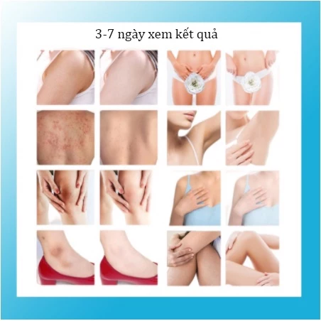 kem dưỡng trắng da toàn thân sữa dưỡng thể làm trắng da kem dưỡng trắng da 300g làm trắng da toàn thân dưỡng ẩm da