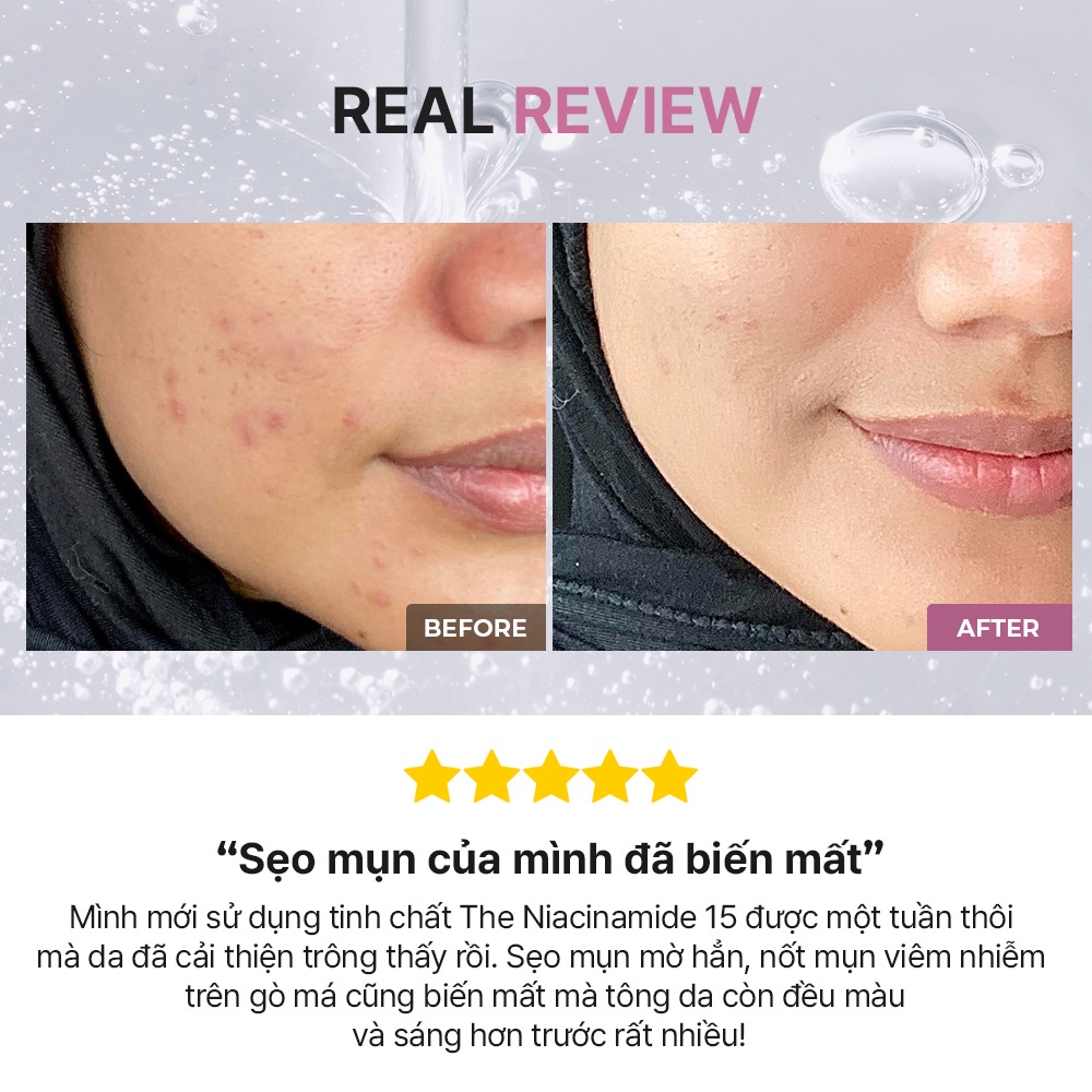 Ảnh Serum COSRX The RX 20ml Niacinamide 15% chăm sóc da mụn/ Vitamin C 23% & 13% cải thiện tông da/ Hyaluronic 3% làm mát dịu da 4