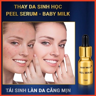 [Hot] Thay Da Sinh Học Peel Serum Baby Milk 10ml - Hàng Hiệu Cao Thiên Nhi