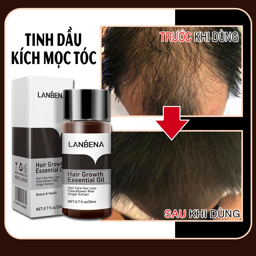 ChÍnh HÃng Tinh Chất Kích Thích Mọc Tóc Lanbena Giảm Gãy Rụng Dầu Gội Mọc Tóc Nhanh 20ml 0157