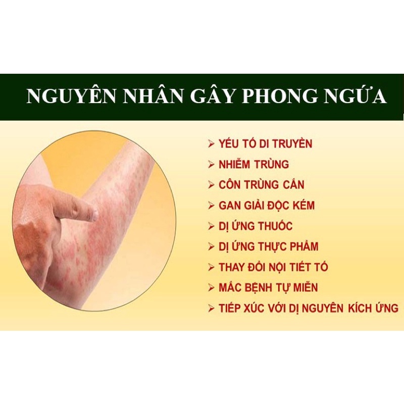 PHONG NGỨA GIA TRUYỀN THIÊN PHÚC 50ml