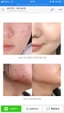 NƯỚC HOA HỒNG SOME BY MI HỖ TRỢ MỤN TÁI TẠO DA AHA - BHA - PHA