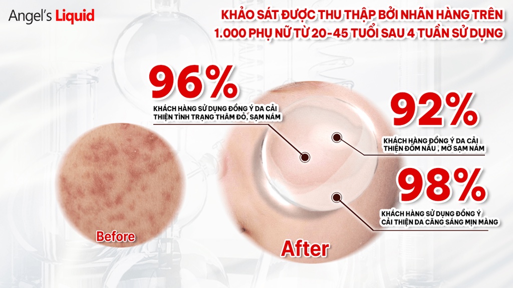 Mô tả Siêu Tinh Chất Xoá Thâm Đỏ Mờ Sạm Nám Angel's Liquid Tranexamic Mela Ampoule 30ml - 6