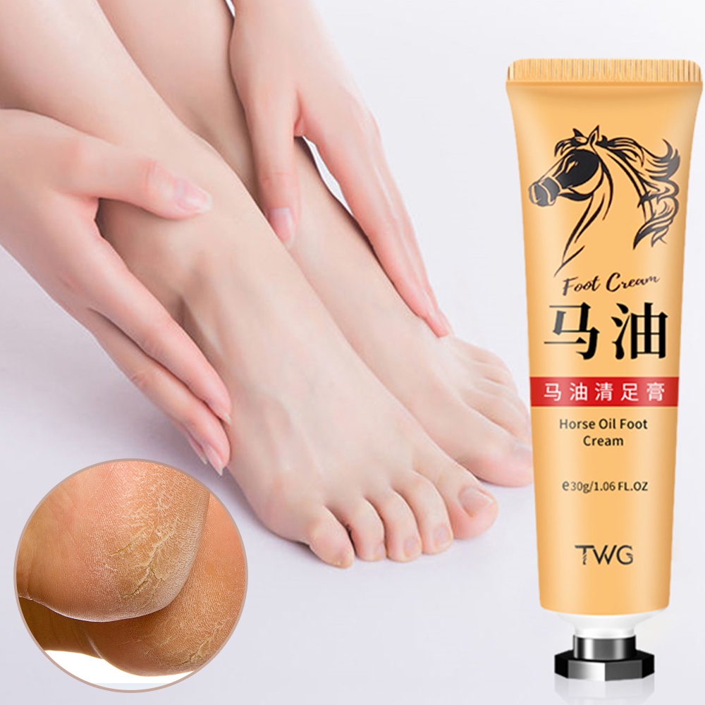 1 Tuýp Kem Dầu Ngựa Trị Nứt Gót Chân Chống Khô Da