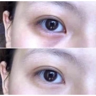 [Chỉ Bán Hàng Thái]Kem giảm thâm, bọng, nhăn vùng mắt Thái Lan 5ML
