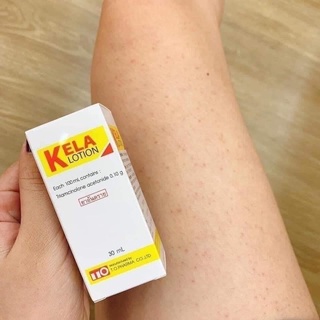 [CHỈ BÁN HÀNG THÁI] LOTION KELLA VIÊM LỖ CHÂN LÔNG,  VIEM DA THÁI LAN