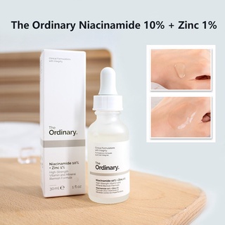 Tinh chất sáng da The ordinary Niacinamide 10% + Zinc 1% (30 ml) giảm dầu, giảm mụn, mờ thâm sau mụn