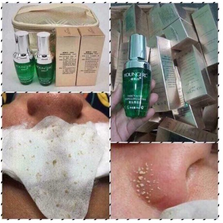 Serum Ủ Mụn, Ủ Mụn Đầu Đen, Mụn Cám Hiệu Quả Chuyên Dùng Cho Spa Thẩm Mỹ Viện