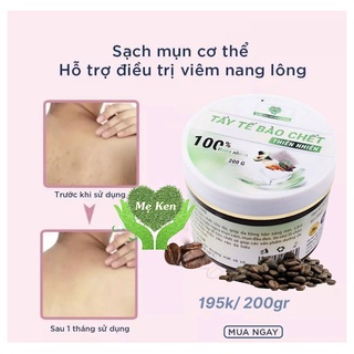TẨY TẾ BÀO CHẾT THẢO MỘC MẸ KEN (DÀNH CHO BODY) 200ml