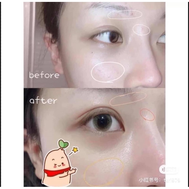 Kem Dưỡng Avene Phục Hồi Da Cicalfate Restorative Skin Cream