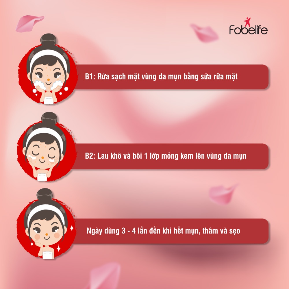 Combo 3 Kem Giảm Mụn Đầu Đen, Đầu Trắng, Mụn Cám ACNEVIR SANTAFA - Tuýp 15gr